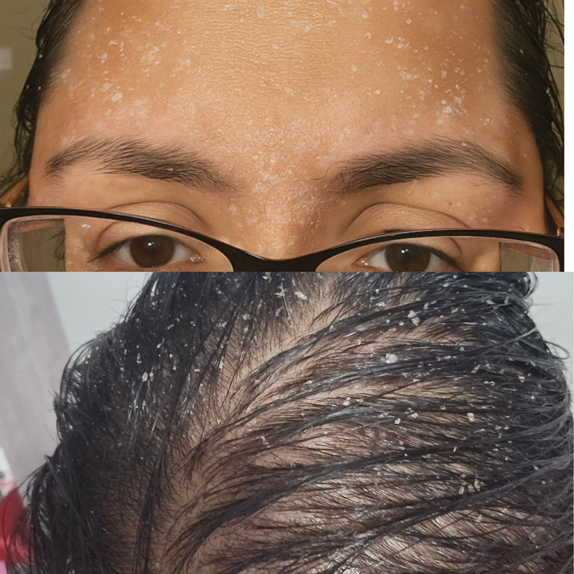 UNDERSTAND YOUR SKIN